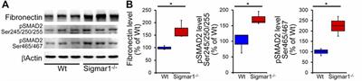 Sigmar1 ablation leads to lung pathological changes associated with pulmonary fibrosis, inflammation, and altered surfactant proteins levels